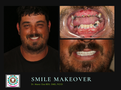 Mike website Smile makeover (500 × 375 px)
