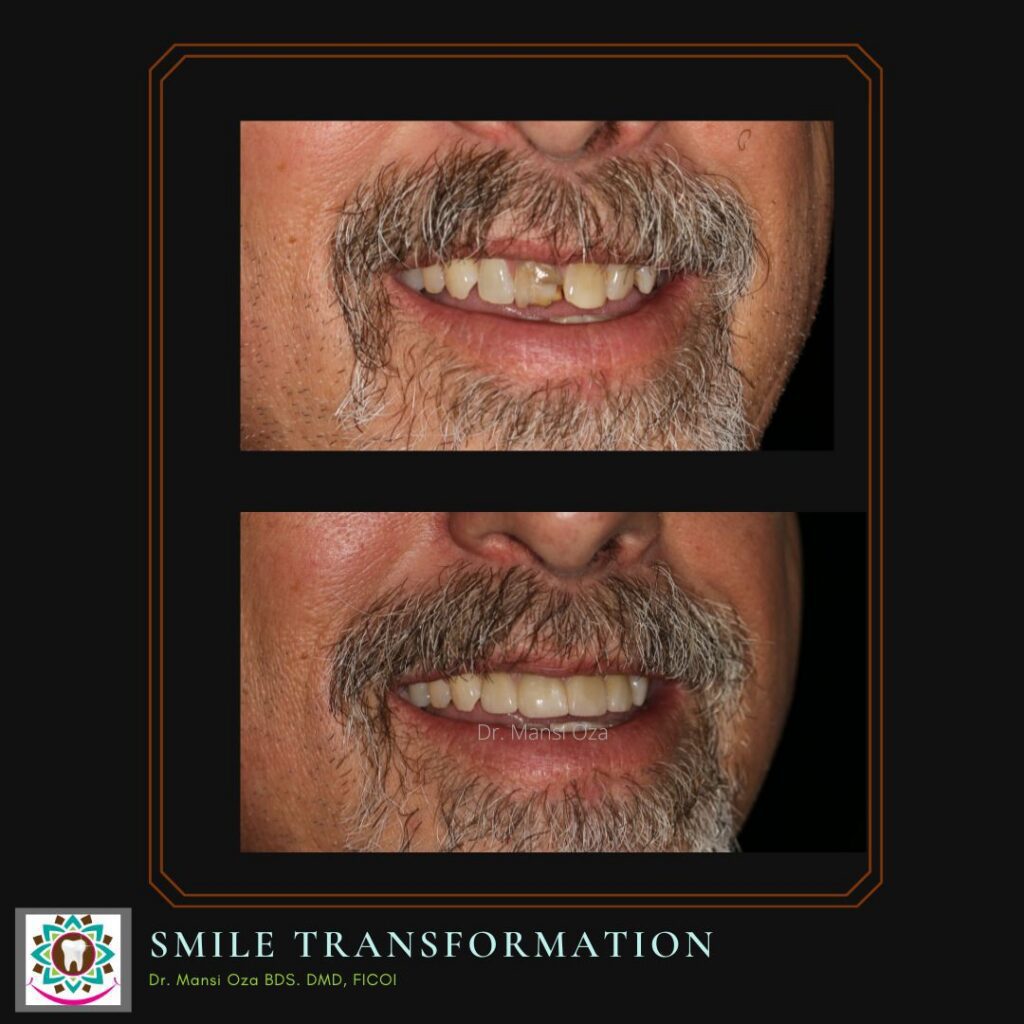 ! Neil for insta before and after portrait and close ups